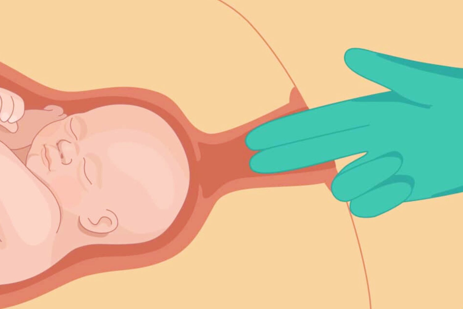 How to Check Dilation with Fingers