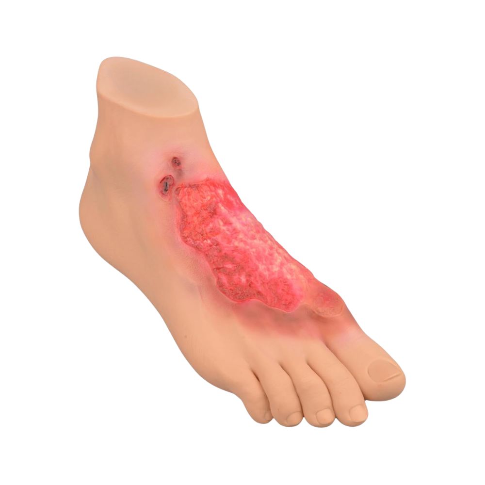 Chemical Burn Simulation Foot Model for First Aid Training