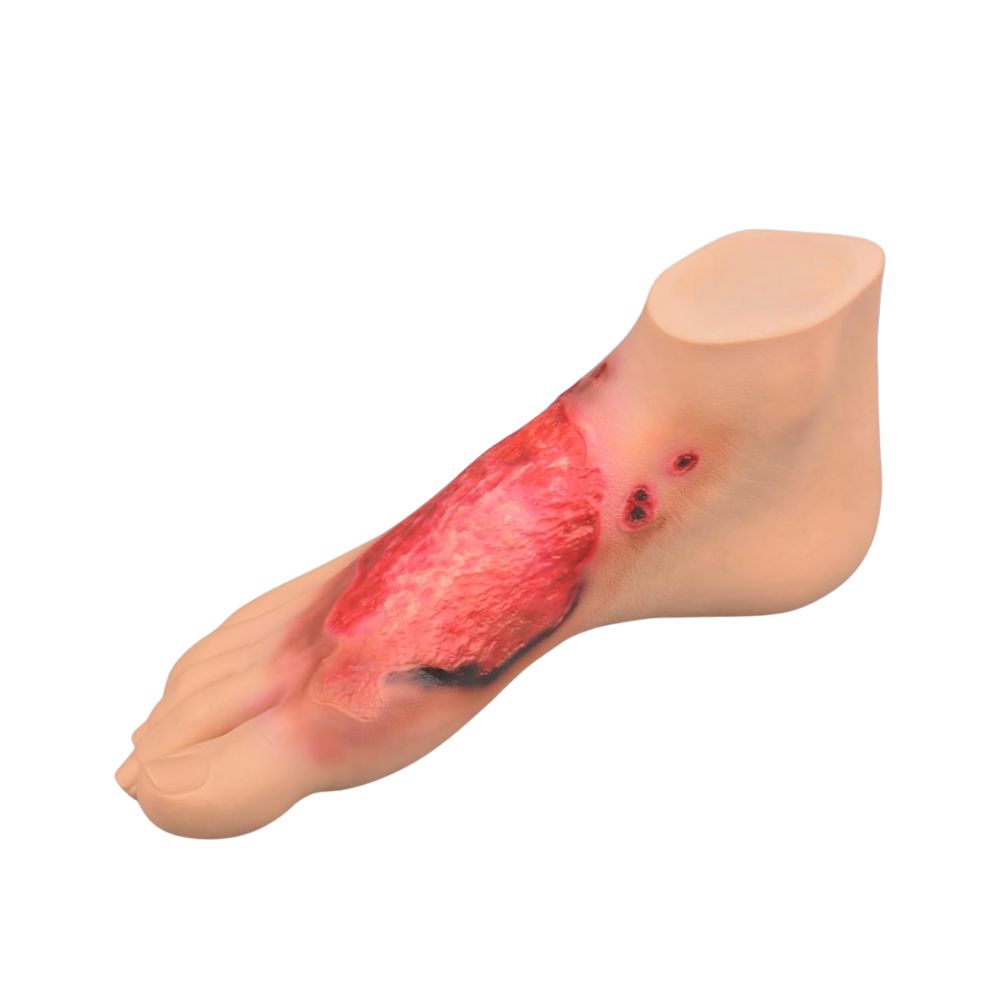Chemical Burn Simulation Foot Model for First Aid Training