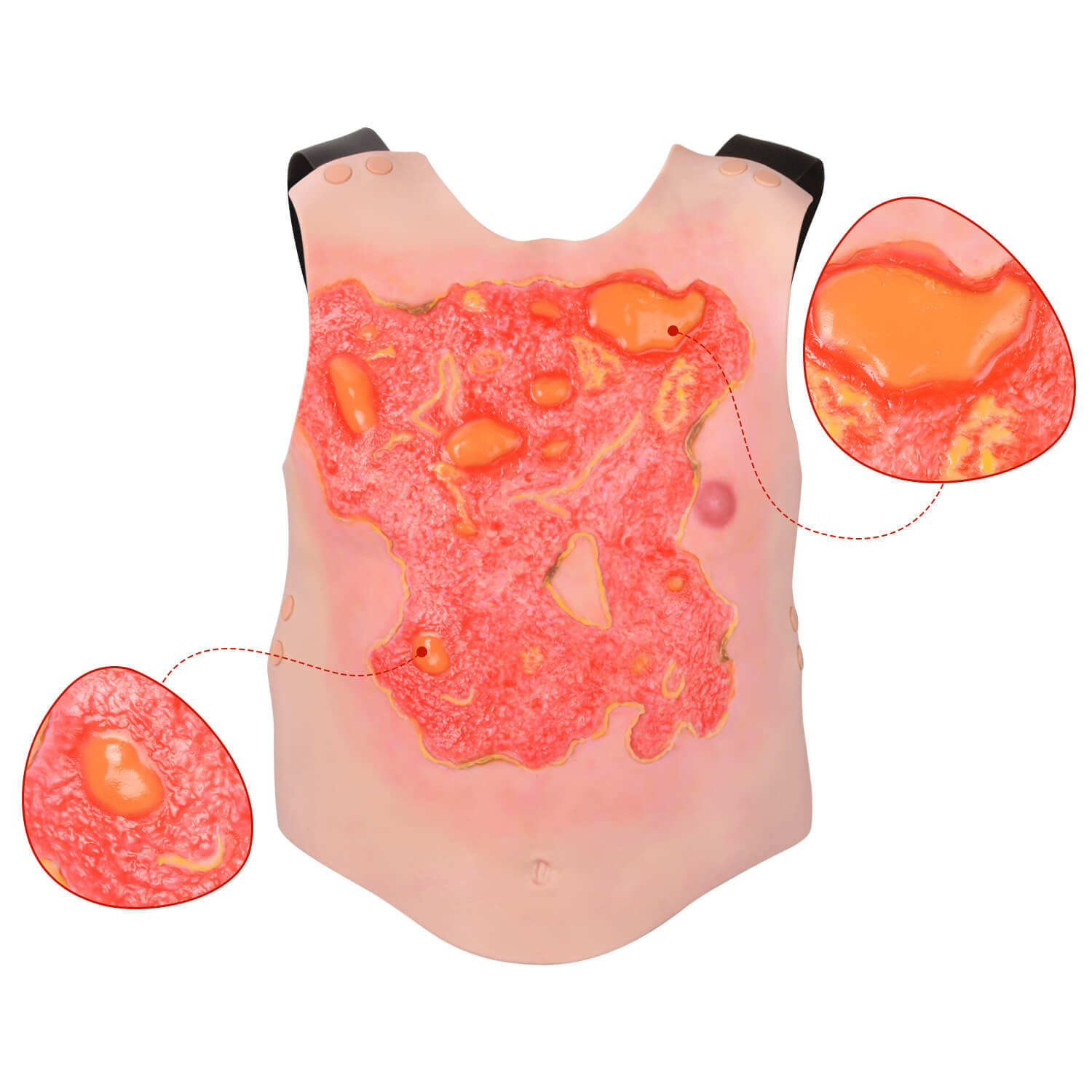 Wearable Chest Scald Wound Training Model
