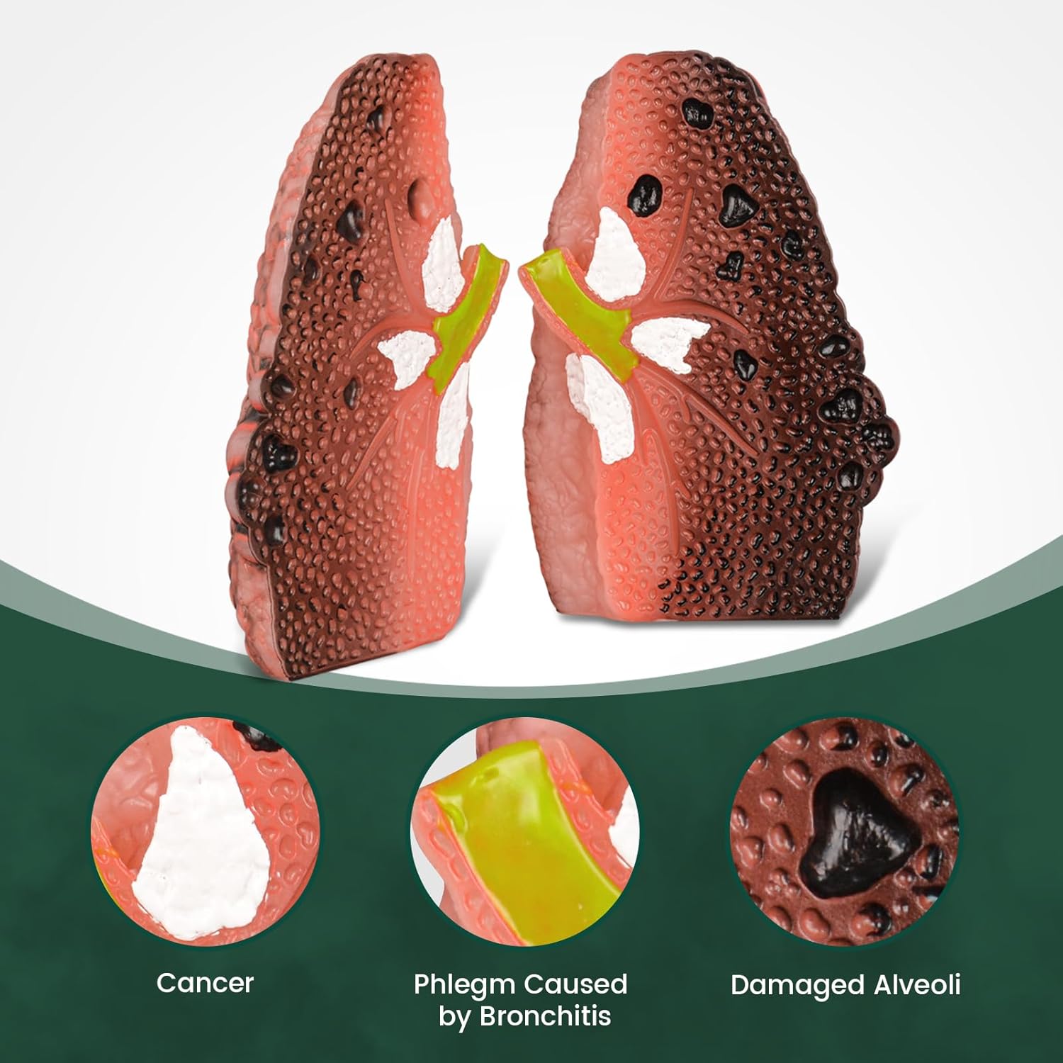 Cough Up Lung Model with Cross-Section Pathology