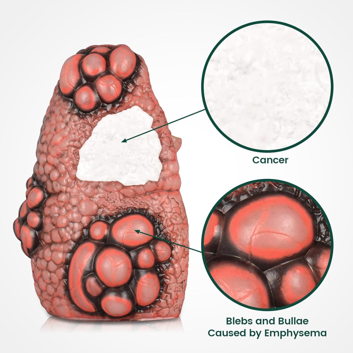  Smoking Cough Up Lung Model with Cross-Section Pathology