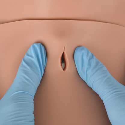 Ultrassist Cricothyrotomy Model for Emergency Training 
