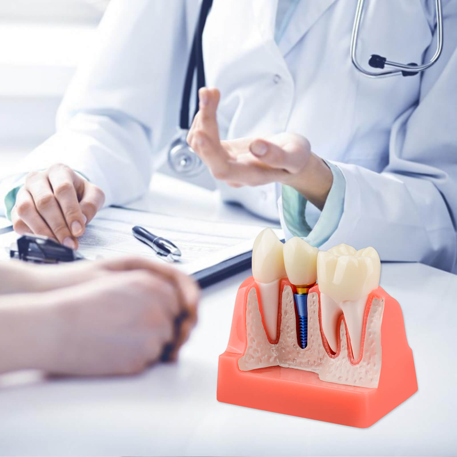 4X Dental Implant Model with Crown & Bridge - Pink