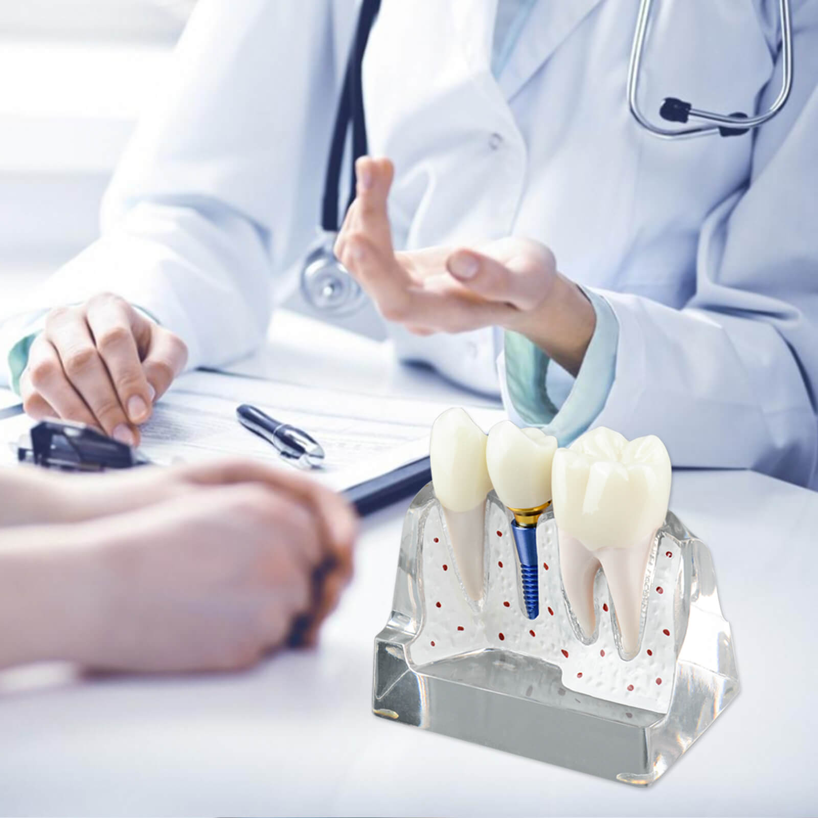 4X Transparent Dental Implant Model with Bridge & Crown