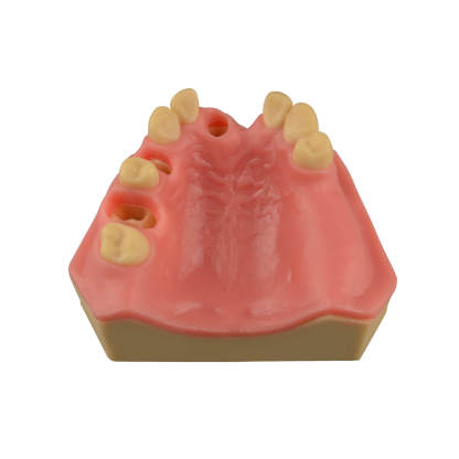 Dental Implant Training Practice Maxillary Model with Sinus