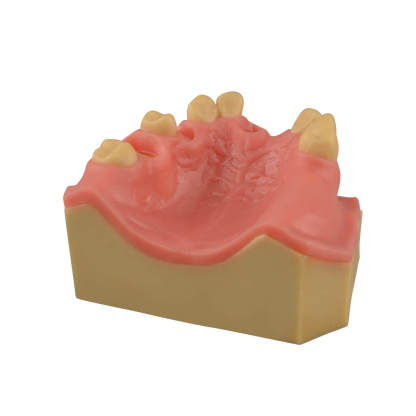 Dental Implant Training Practice Maxillary Model with Sinus