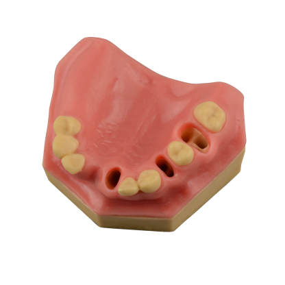 Dental Implant Training Practice Maxillary Model with Sinus