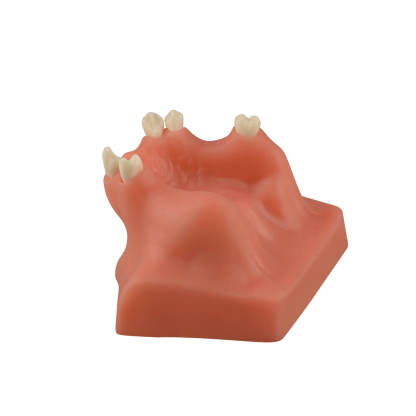 Dental Sinus Lift & Implant Practice Model - Type B