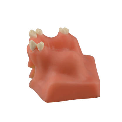 Dental Sinus Lift & Implant Practice Model - Type B