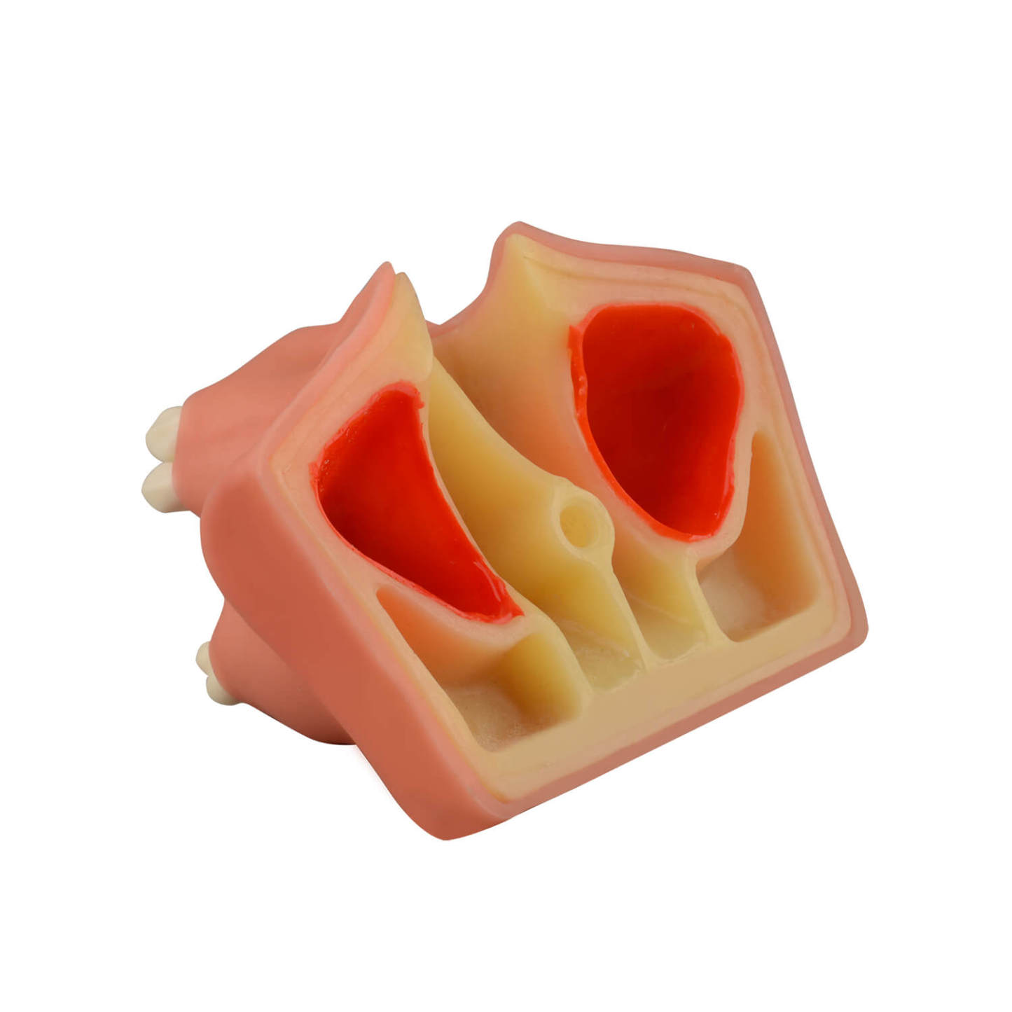 Dental Sinus Lift & Implant Practice Model - Type B