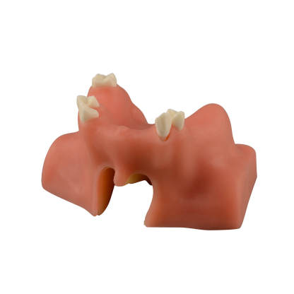 Dental Sinus Lift & Implant Practice Model - Type B