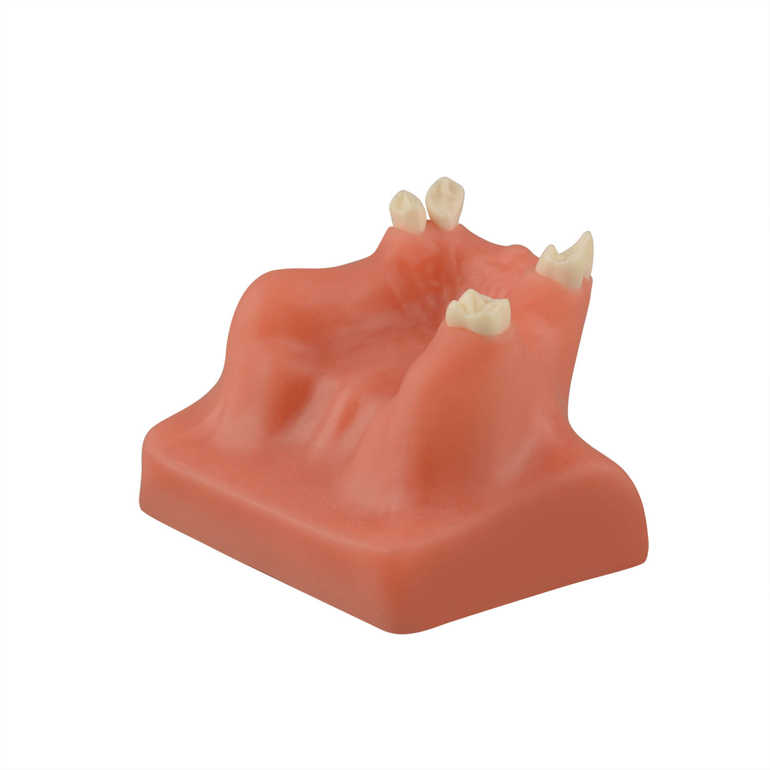 Dental Sinus Lift & Implant Practice Model - Type B