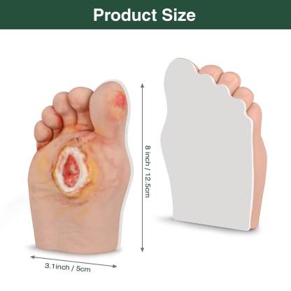 Ultrassist Diabetic Foot Ulcer Grading Model Set - 5 Stages Diabetes Complication Simulator