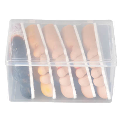 Ultrassist Diabetic Foot Ulcer Grading Model Set - 5 Stages Diabetes Complication Simulator