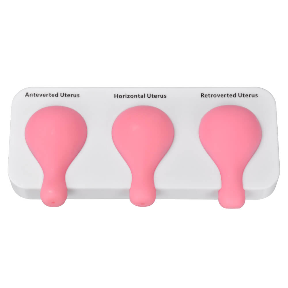 Dilatation and Curettage (D&C) Uterus Model with Base
