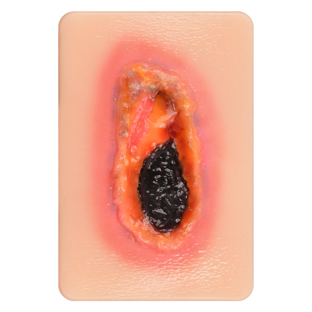 Pocket-Sized Necrotic Tissue Wound Simulation Model Set
