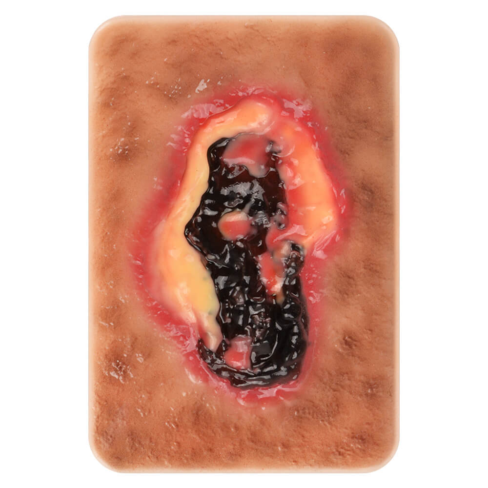 Pocket-Sized Necrotic Tissue Wound Simulation Model Set