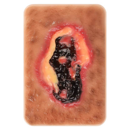 Pocket-Sized Necrotic Tissue Wound Simulation Model Set