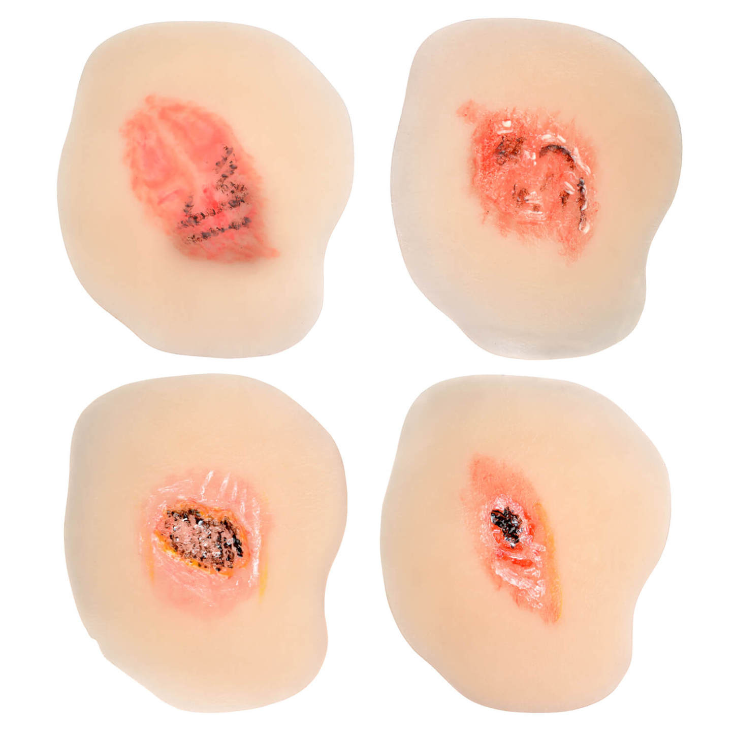  Sticky Dry Wound Healing Stages Teaching Model (Set of 4)