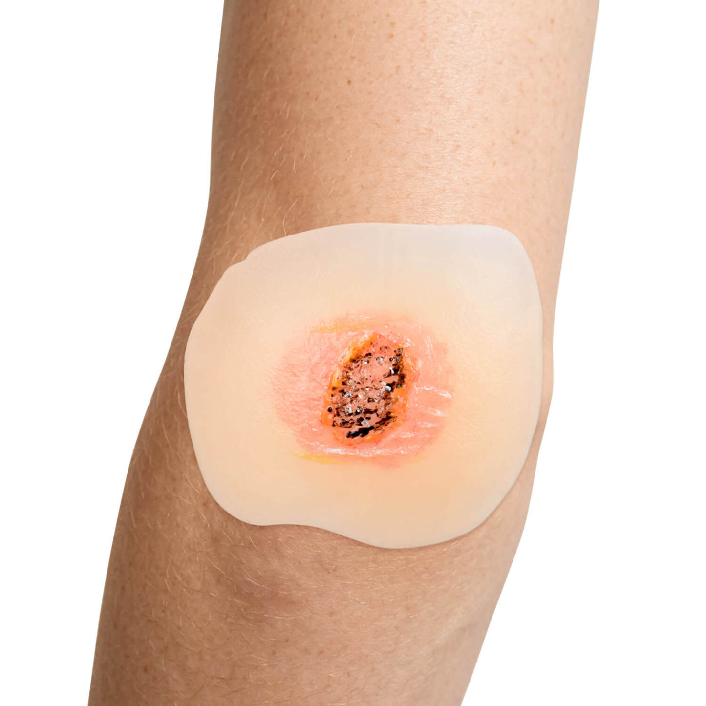  Sticky Dry Wound Healing Stages Teaching Model (Set of 4)