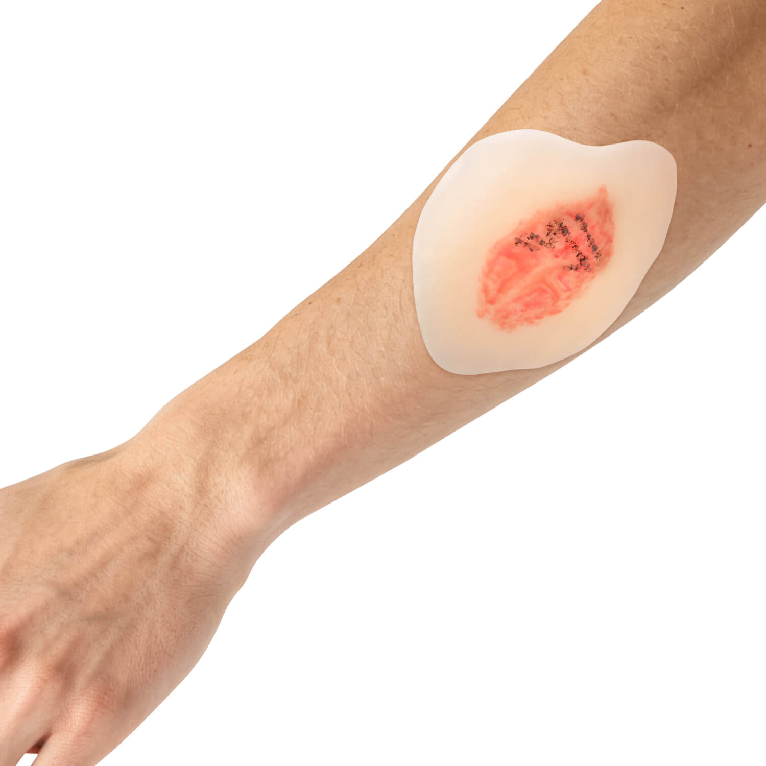 Sticky Dry Wound Healing Stages Teaching Model (Set of 4)