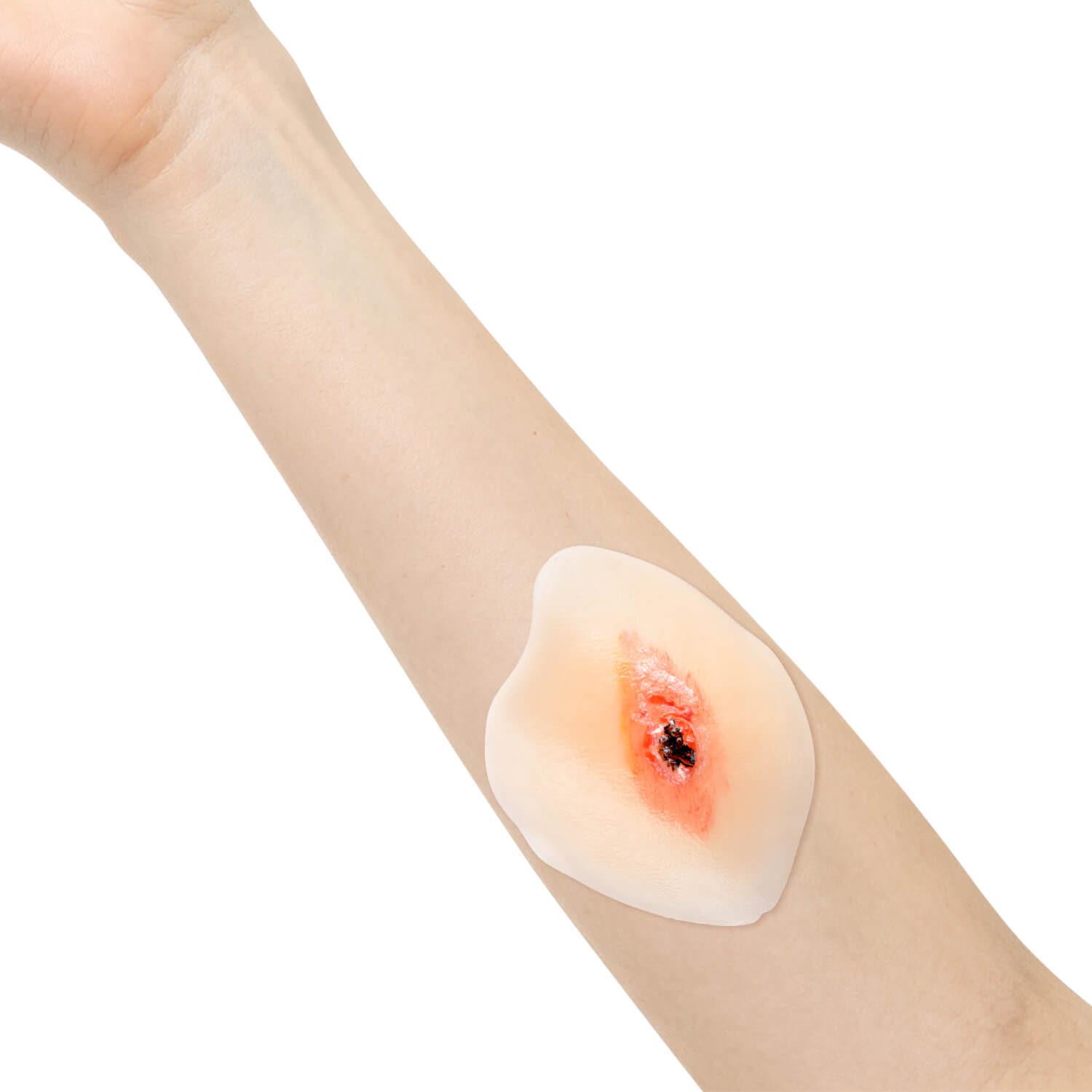  Sticky Dry Wound Healing Stages Teaching Model (Set of 4)