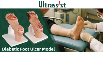 Ultrassist Diabetic Foot Ulcer Model (Full-Foot) Set with Base