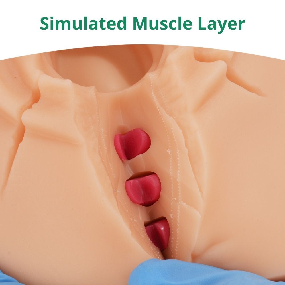 Ultrassist Episiotomy Suturing Trainer with Multiple Incisions