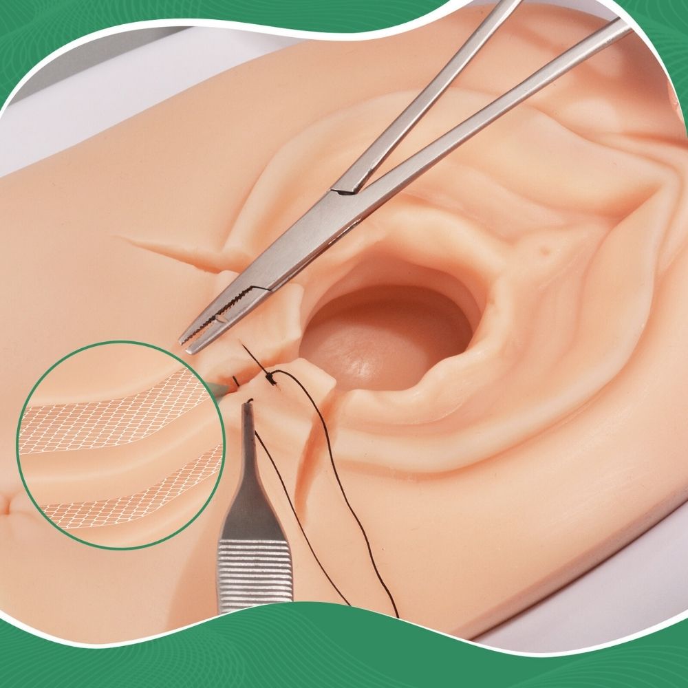 Ultrassist Episiotomy Suturing Trainer with Multiple Incisions
