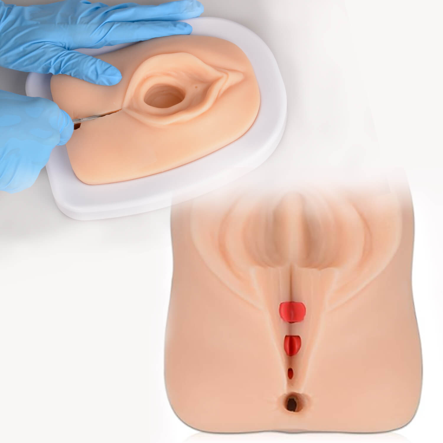  Obstetrics Episiotomy Simulator for Perineal Repair Training