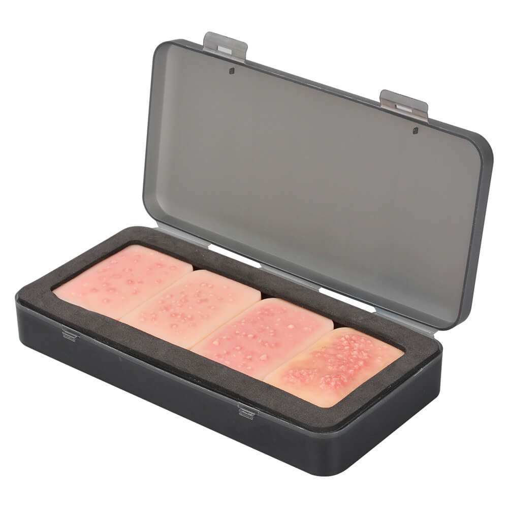 Facial Acne Grading Model for Dermatology Education