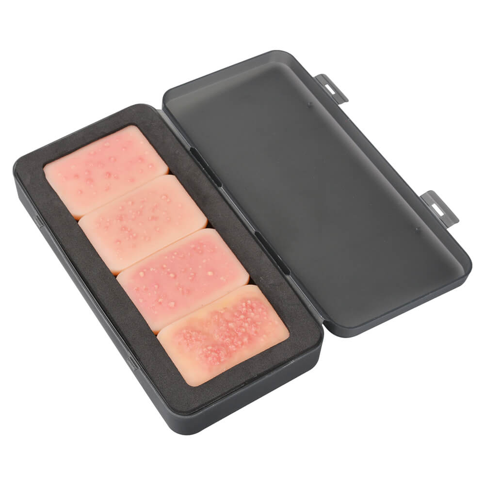 facial acne model set for Dermatology education