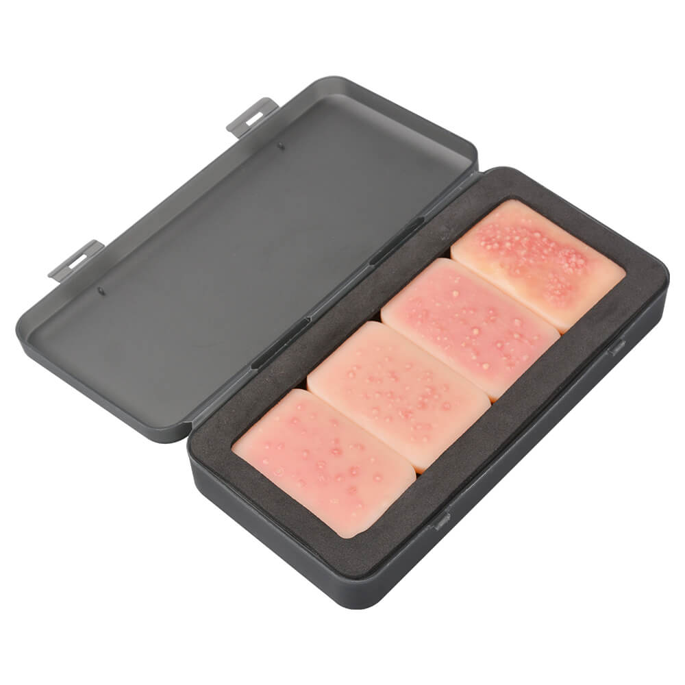 Facial Acne Grading Model Set of 4 with Case