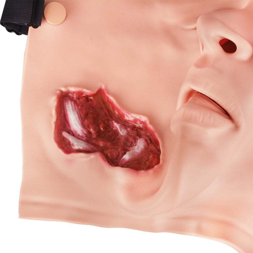 Bleeding Face Trauma Model