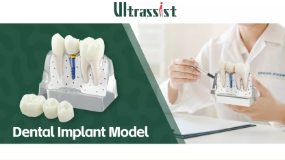 4X Dental Implant Model with Bridge & Crown - Transparent