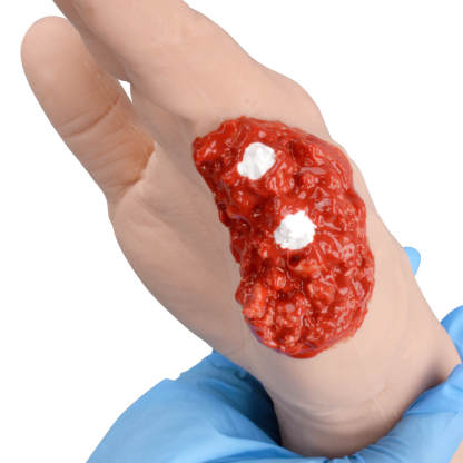 Realistic Finger Amputation Wound Packing Hand