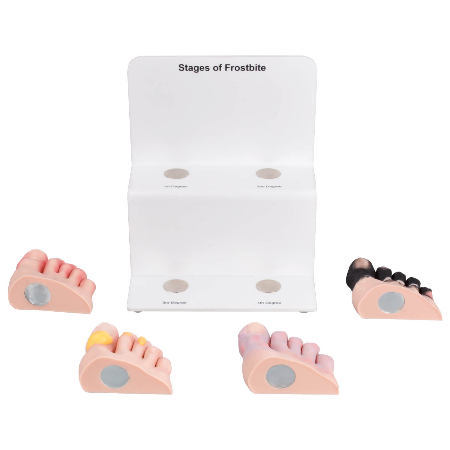 Produktbild von 3-teiliges Fußmodell-Set 1:1 – Normaler, Senkfuß & Hohlfuß – Anatomisch, PVC, Mit Bändern & Muskeln – Für Lehre, Studium & Labor