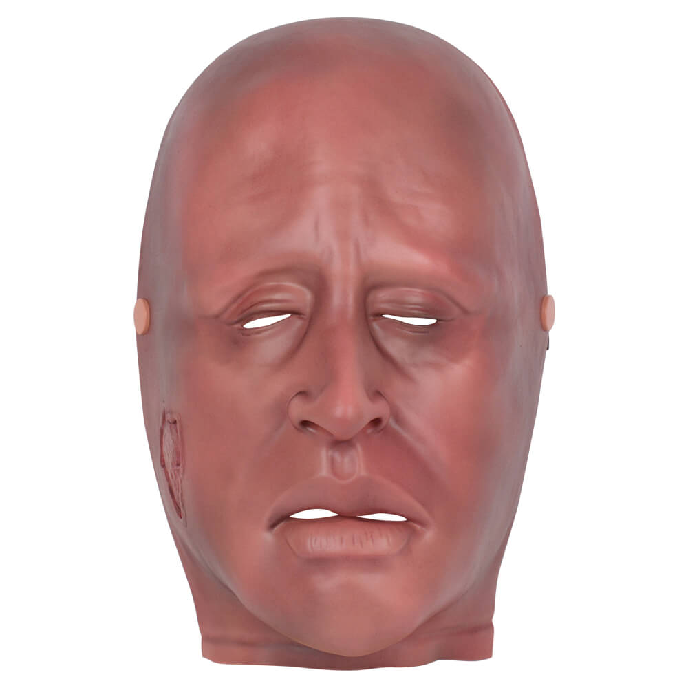 Full-Face Wearable Facial Mild Burn Model