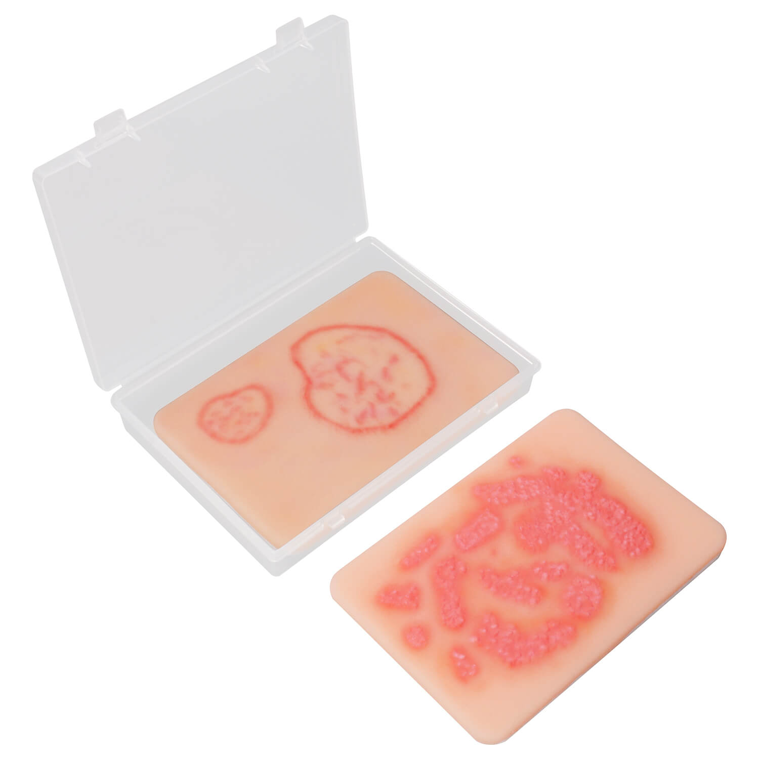 Fungal Skin Infection Wound Simulation Models (Set of 2)
