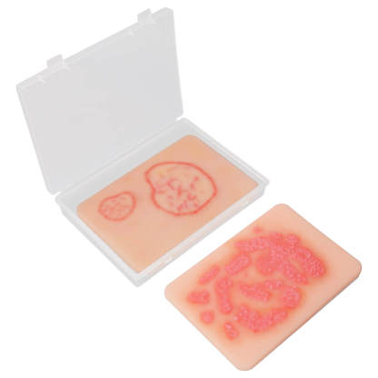 Fungal Skin Infection Wound Simulation Models (Set of 2)