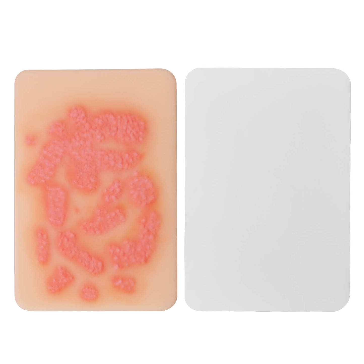 Fungal Skin Infection Wound Simulation Models (Set of 2)