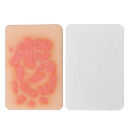 Fungal Skin Infection Wound Simulation Models (Set of 2)