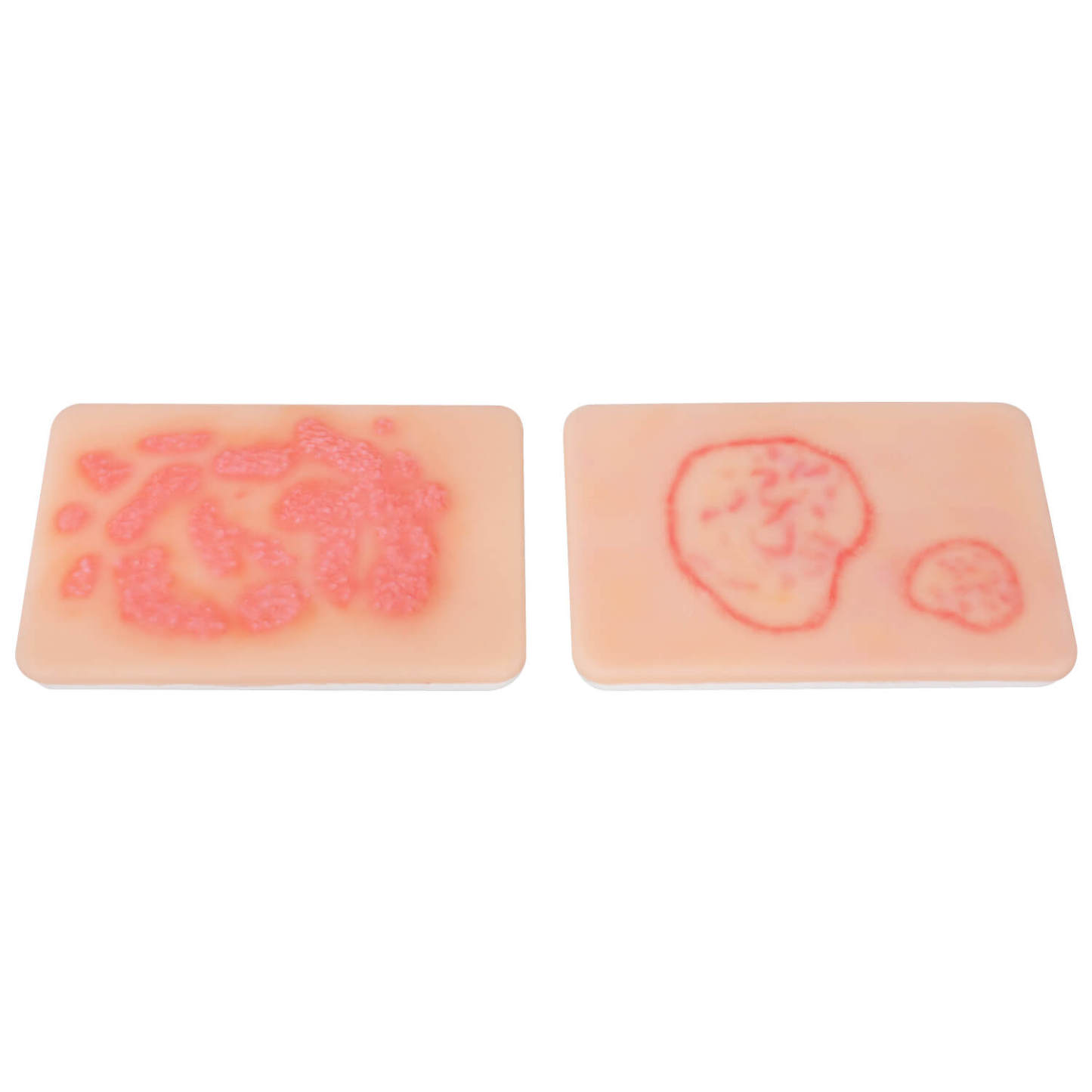 Fungal Skin Infection Wound Simulation Models (Set of 2)