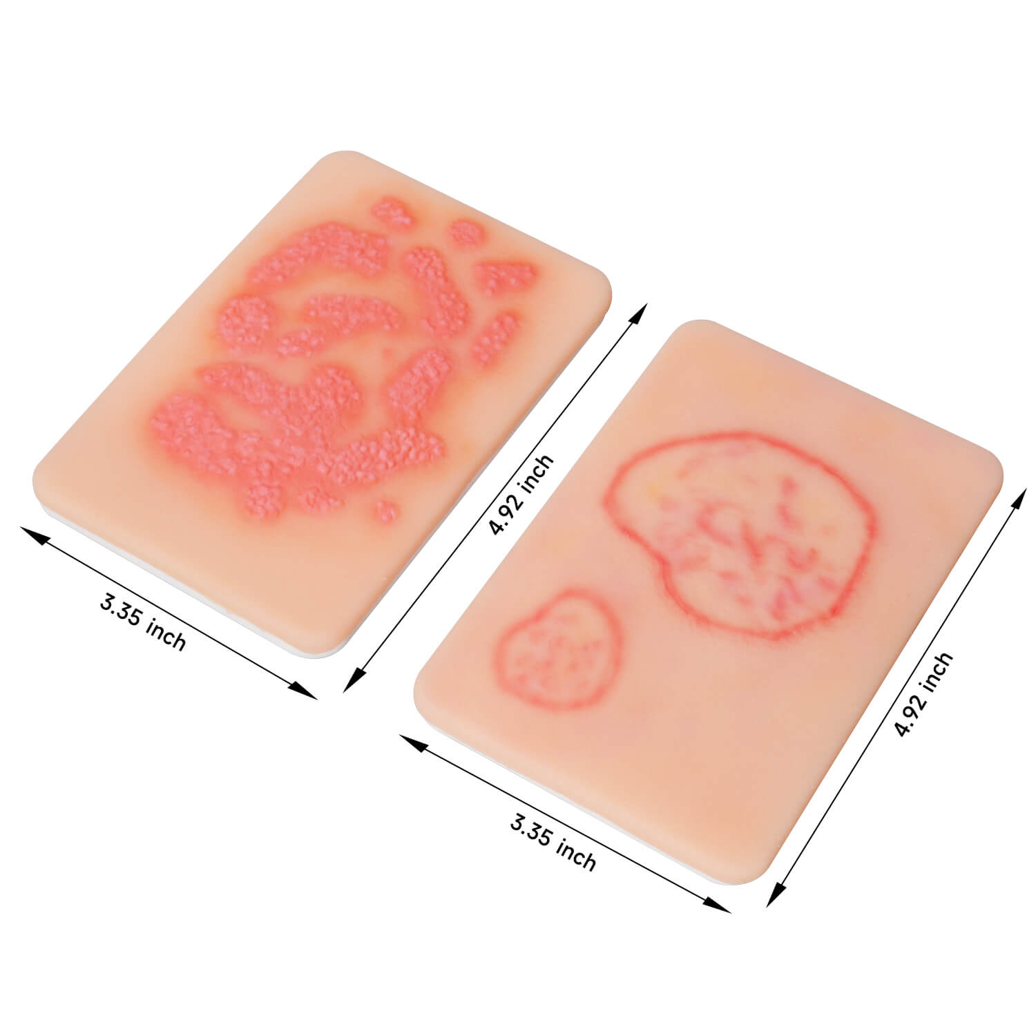 Fungal Skin Infection Wound Simulation Models (Set of 2)