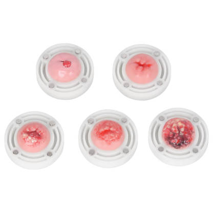 Gynecological Examination Simulator with Replaceable Cervical Modules