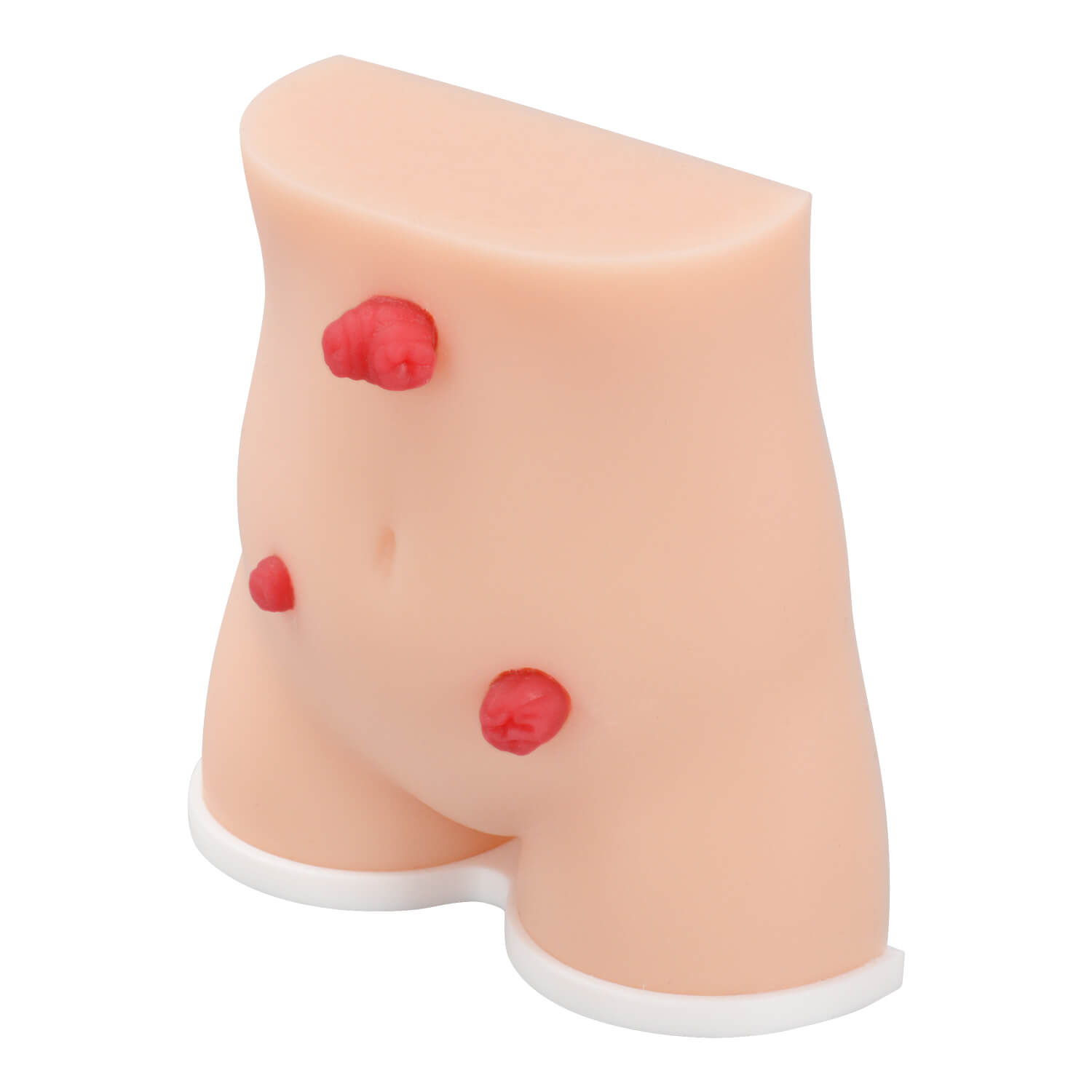 Handheld Stoma Demonstration Models (Set of 2)