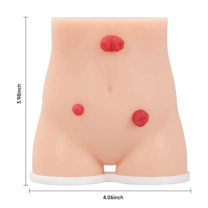 Handheld Female Stoma Demonstration Model Size