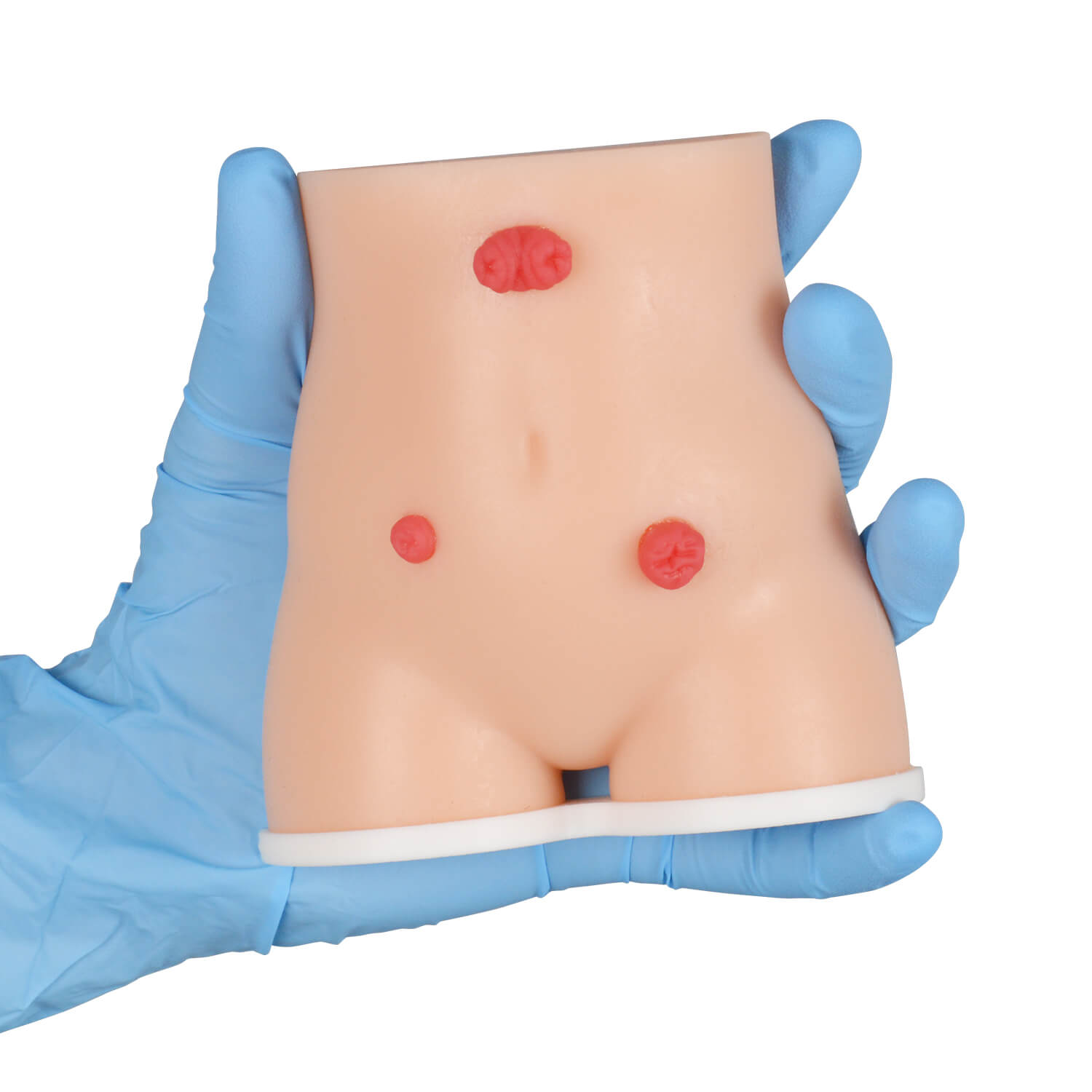 Handheld Stoma Demonstration Models (Set of 2)