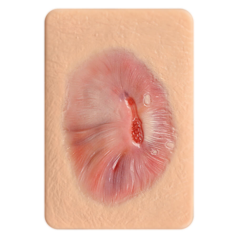 Granulation Tissue Wound Simulation Models Set